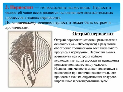 Периостит у детей - статьи детской стоматологической поликлиники «Мартинка»