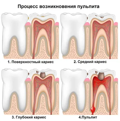 Флюс - причины появления, симптомы заболевания, диагностика и способы  лечения