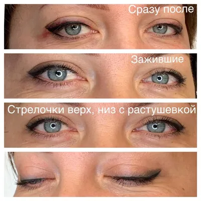 Фото татуажа бровей до и после - фотогалерея работ перманентного макияжа  LBar.com.ua