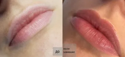 Татуаж губ в Выхино и Новогиреево техниками: акварельная и помадная, перманентный  макияж губ - фото до и после, отзывы - Brows Zone