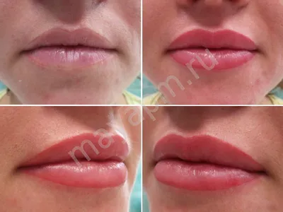 Татуаж губ: фото до и после с растушевкой | Елена Ольшанская | Дзен