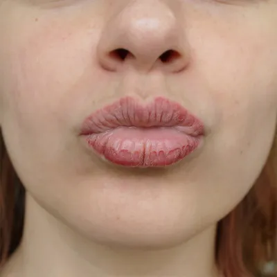 ПЕРМАНЕНТНЫЙ МАКИЯЖ | ТАТУ |ТАТУАЖ |МОЗДОК on Instagram: \"Как заживают губы  после перманентного макияжа: этапы и фото после восстановления 🔺вторая  часть ▪️Этапы восстановления с фото по дням Кожа на губах тонкая и