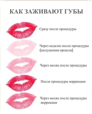 Этапы заживления после перманентного макияжа губ. | ВКонтакте