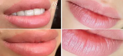Заживший перманентный макияж губ. Восстановление природного цвета губ.… |  Instagram