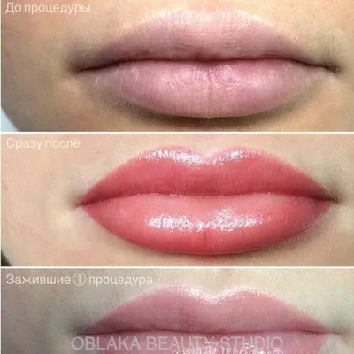 Татуаж Туапсе - 👄Сексуальность на виду...👄 ⠀ 💄Это я про губы которые  всегда выражают женскую сексуальность🥰 ⠀ 🍭Процесс заживления  перманентного макияжа губ ⠀ 💫Процедура перманентного макияжа(татуажа)  сложный процесс. ⠀ 📢 Собираясь на