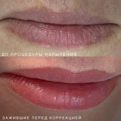 Перманентный макияж губ. Фото до и после | Фото татуаж губ