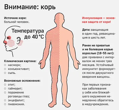 Об эпидемиологической ситуации по кори