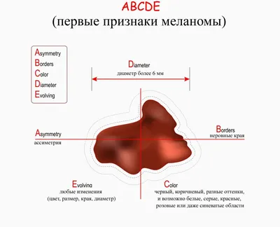 Рак кожи: первые признаки - ToBeWell