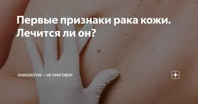 Лечение рака кожи в Киеве - цены и отзывы в клинике Оксфорд Медикал