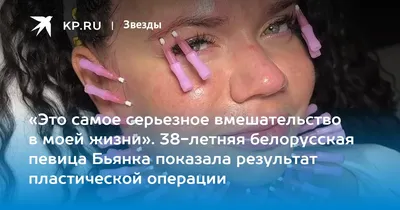В водолазке с гипюром и без косметики: Бьянка показала архивное фото — а  фолловеры ее не узнали | WMJ.ru