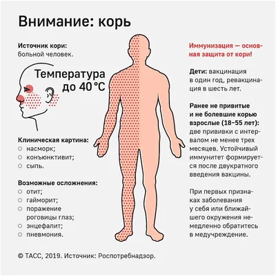 Корь: как отличить от ОРВИ, и что делать, если заболели? Сохраняйте пост,  чтобы знать все самое главное об этом заболевании - увы, оно не… | Instagram