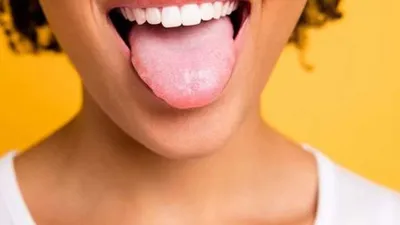Статьи о здоровье полости рта — советы по уходу за зубами и деснами |  Dental-MM