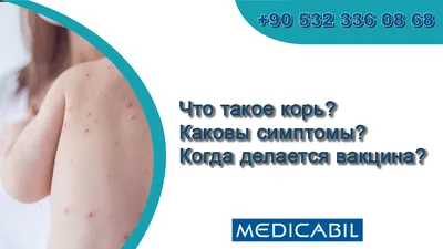 Blog | Что такое корь? Каковы симптомы? Когда делается вакцина?