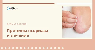 Лечение псориаза ногтей в Москве – лечение ногтей на руках и ногах в  клинике MedNail