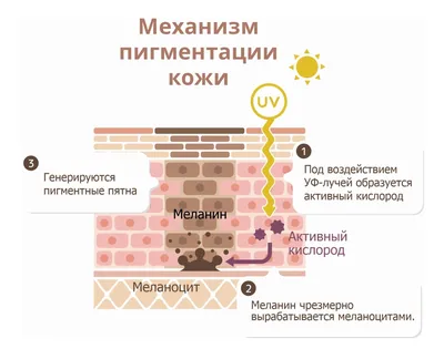 Как убрать пигментные пятна с лица: эффективные процедуры для быстрого  избавления от гиперпигментации