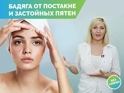 Евро плюс - Гель \"Бадяга косметическая\": купить по лучшей цене в Украине |  Makeup.ua