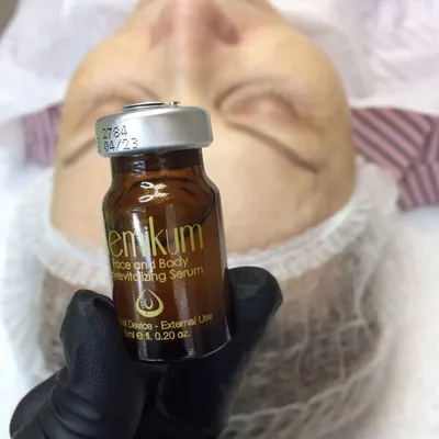 Косметолог Вишневое's Instagram profile post: “🏆Kemikum – химический пилинг  с абсолютно уникальной и инновационной форму… | Revitalizing serum, Face  and body, Body