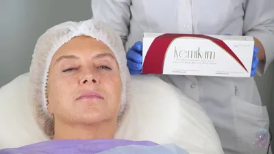 Биовосстанавливающий пилинг KEMIKUM - инновационный пилинг для омоложения и  восстановления кожи без реабилитации! | ВКонтакте