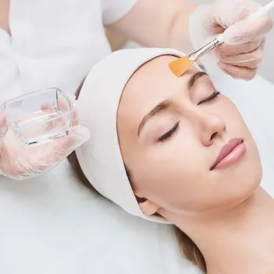 Химический пилинг кожи лица и тела: что это такое, виды пилинга | Beauty  Insider
