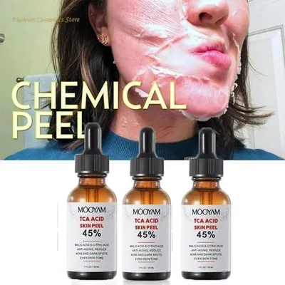 TCA 50% химическая пилинг Tca пилинг кислотная пилинг кожи супер сила  пигментация шрамы от акне осветляет кожу | AliExpress