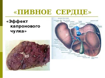 Патриотическая пивная кружка 0.5 л Ukraine сердце. Кружка пивная Ukraine  сердце. (ID#1649925262), цена: 299 ₴, купить на Prom.ua