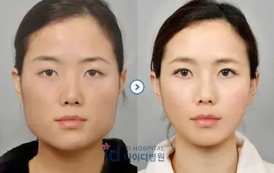 Пластическая хирургия в Корее