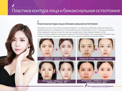 Пластическая хирургия в Корее / До и после / Plastic Surgery in Korea /  Before and After HD - YouTube