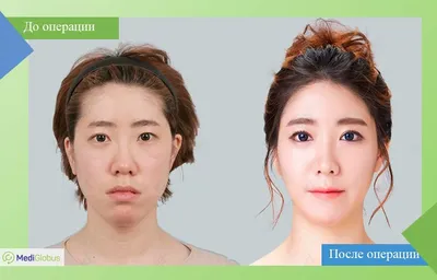 Пластическая хирургия Сеула | Gangnam Group Plastic Surgery