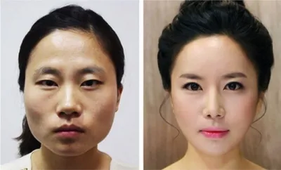 Как выглядят азиатские звёзды после пластики: фото до операции и сейчас  корейские актеры до и после пластики