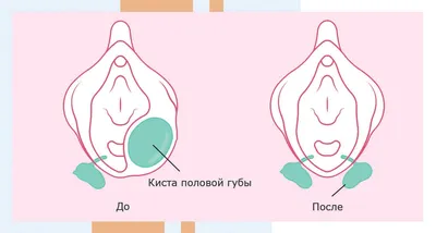 Как выглядят самые большие губы в мире: 8 девушек, переборщивших с  филлерами гиалуроновой кислоты