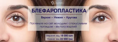 Блефаропластика век в Минске - Цены на пластику век в Беларуси