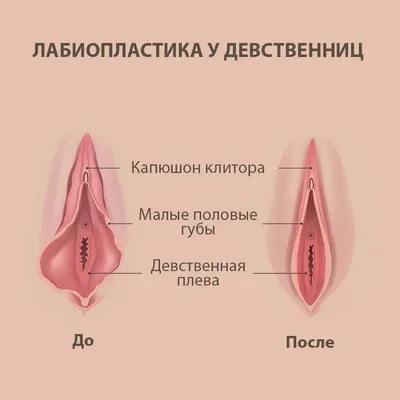 Фото до и после контурной пластики | Damas Medical Center