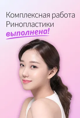 POP Plastic Surgery Russia - ПЛАСТИКА НОСА В КОРЕЕ ⠀📲 WhatsApp / Imo :  010-5037-0025 Нос, о котором Вы мечтали! ⠀⠀⠀⠀ Ринопластика - это  пластическая операция, направленная на исправление эстетических недостатков  носа.