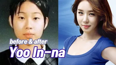 Ты не поверишь этим фото: 10 корейских звезд до и после пластики | theGirl