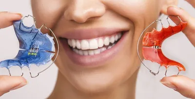 Пластинки для зубов детям - виды, как ставят, сколько носить?