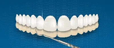 Ортодонтический аппарат для исправления прикуса Marco Rosa Несъемная  пластинка Марко Роса для расширения верхней челюсти - «Быстрое исправление  в сменном прикусе» | отзывы
