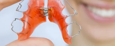 Купить ортодонтические вестибулярные пластинки для зубов: цены и фото
