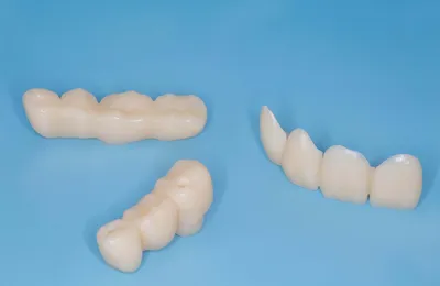 Пластмассовые коронки на передние зубы фото фото