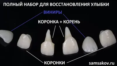 Пластмассовые коронки на зубы в Москве – цены, отзывы на установку  пластиковых коронок в стоматологических клиниках Зуб.ру