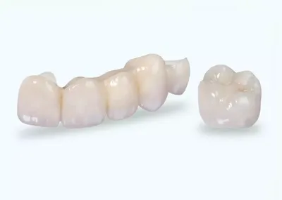 Коронка на зуб. Зубные коронки • Цена в Amel Smart Clinic ᐉ Днепр
