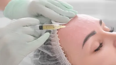 PRP-терапия для волос и лица. Высокоэффективный плазмолифтинг прп-терапия  для лица и волос. Доступная цена в Москве в VIP Clinic