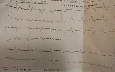 Дела житейские #43: ЭКГ | Пикабу