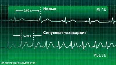 АМАЭ - клиника для детей - Приём кардиолога с ЭКГ.❤️ Расскажем подробнее,  как проходит прием кардиолога в нашей клинике В начале приёма врач или  медсестра сделают электрокардиограмму, результаты которой помогут сразу  провести