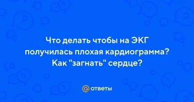 Брадикардия сердца: причины, симптомы, диагностика и лечение