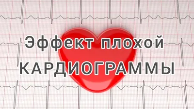 Эффект плохой кардиограммы. #сердце #кардиолог #аритмия - YouTube