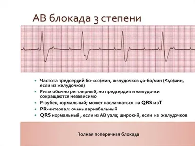 ЭКГ в Хабаровске для взрослых и детей в \"Арт Медик\".