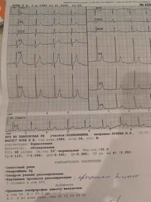 Не чего не беспокоило, а кардиограмма плохая - Вопрос кардиологу - 03 Онлайн