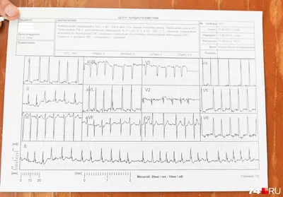 Электрокардиография с нагрузкой | Детский медицинский центр \"ЧудоДети\"