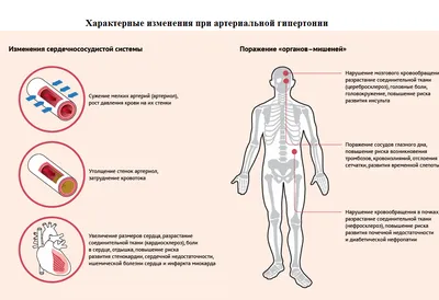 Нормальная ЭКГ: зубец Т