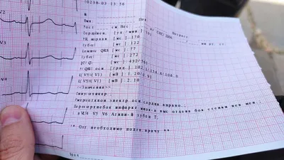 ЭКГ в Хабаровске для взрослых и детей в \"Арт Медик\".
